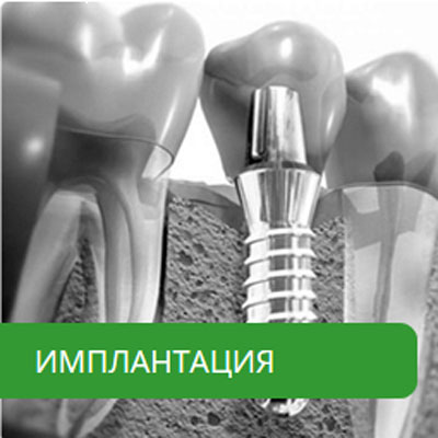 преимущества франчайзинга стоматологической клиники доктора Разуменко