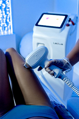 Франшиза студии лазерной эпиляции ON MY LASER