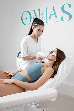 Франшиза студии лазерной эпиляции ON MY LASER